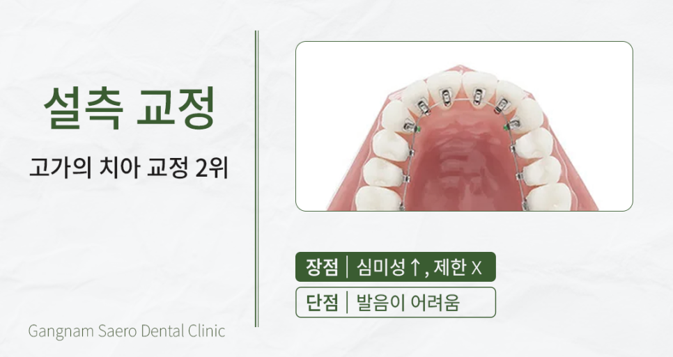A Time- and Money-Saving Approach to Orthodontic Treatment (Orthodontic Treatment Cost) image 6
