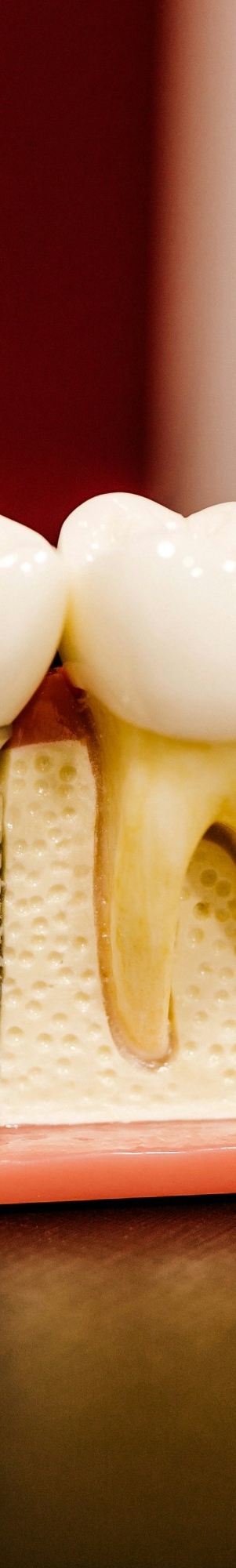 임플란트 식립이 불가능할 수도 있는 건강 상태 알아보기. 관련 이미지 10