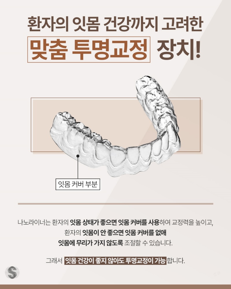 투명교정하기 전 알아두면 도움되는 정보 관련 이미지 9