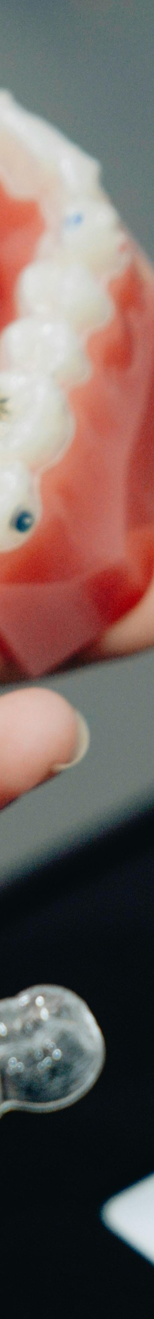 성인치아교정 치료, 부정교합, 구강 건강 개선이 될까요? 고민하고 계시다면 궁금증 타파해드립니다! 관련 이미지 12