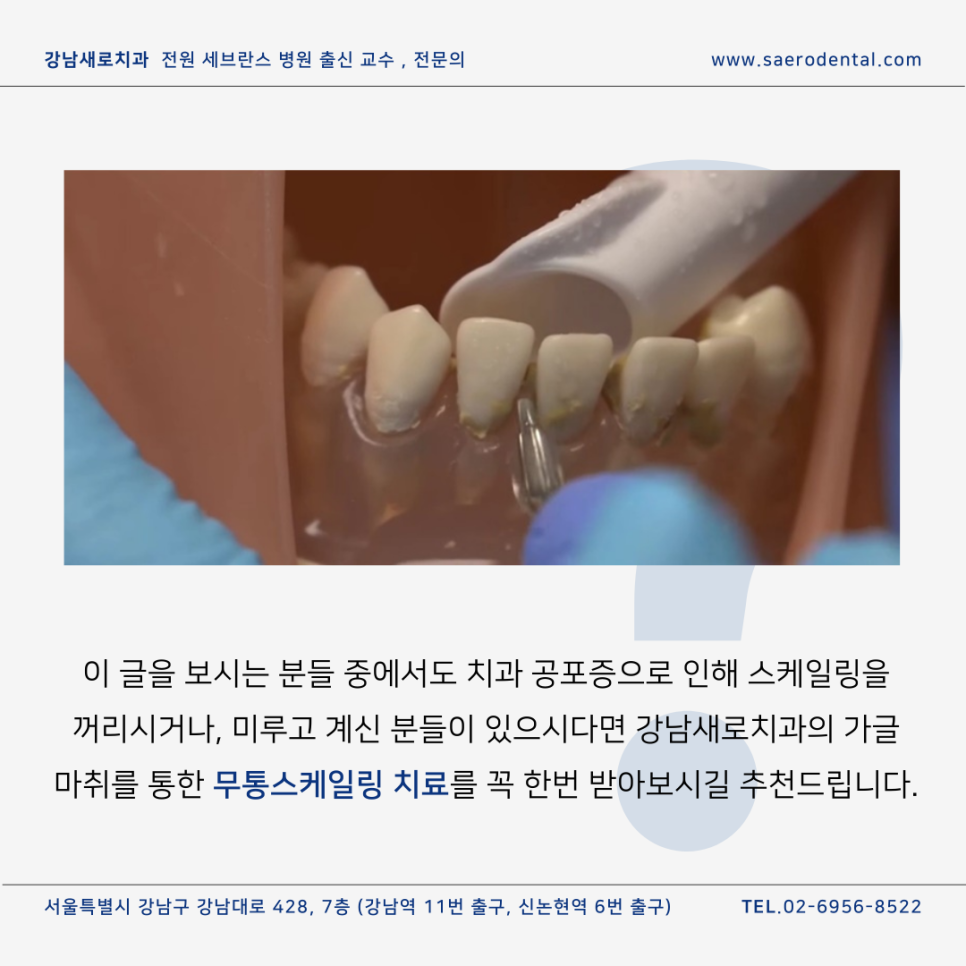 무통스케일링, 관련 이미지 9