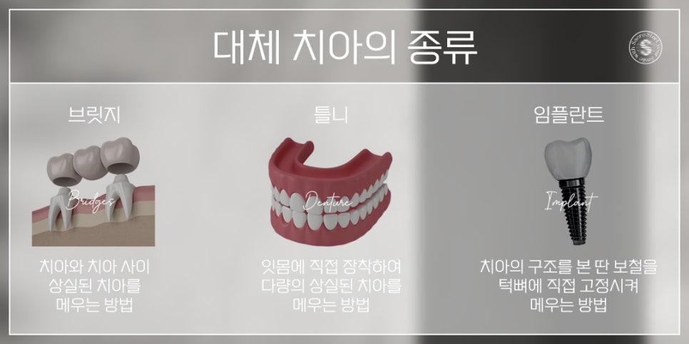 나이가 많은데 임플란트 가능할까요? (65세이상임플란트 건강보험적용) 관련 이미지 4