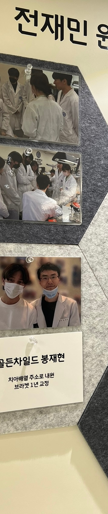 뻐드렁니교정치료, 돌출입을 단기간에 개선하는 방법? 관련 이미지 12