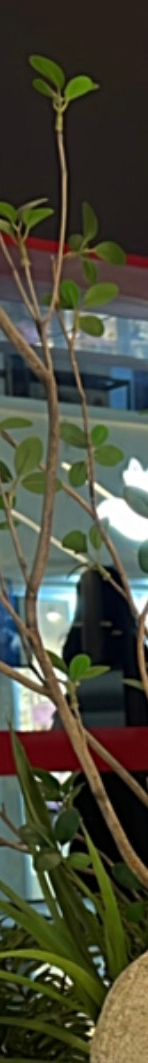 라미네이트재부착 가능할까? 보철물 파절 원인 및 대처 방법 관련 이미지 12