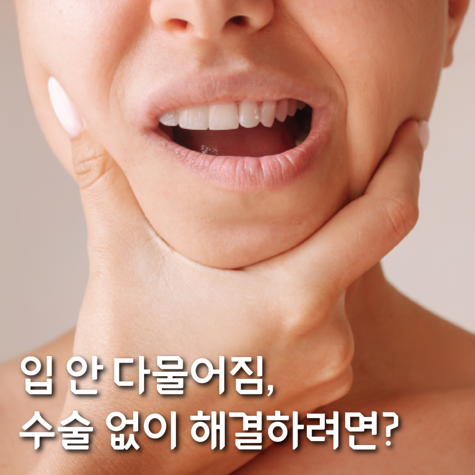 입 안 다물어짐 수술 없이 해결하는 방법 관련 이미지 1