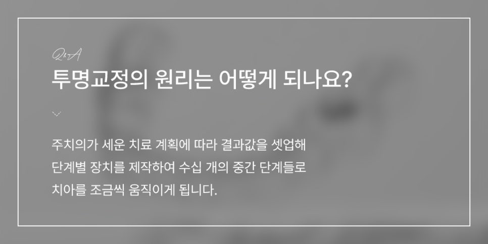 투명교정이 모든 사례에서 가능한가요? (투명교정효과) 관련 이미지 4