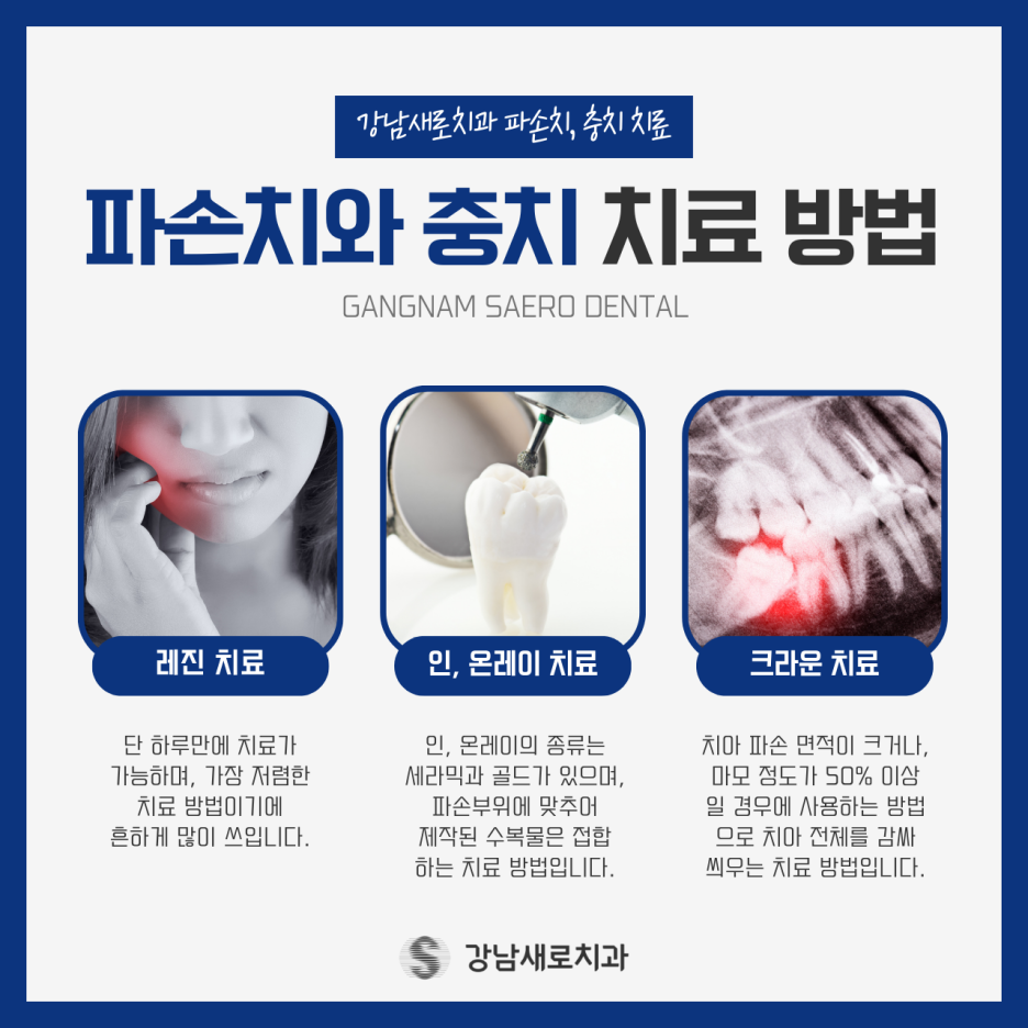 치아파손치료가 필요한 대상과 증상 및 진료 과정 관련 이미지 2