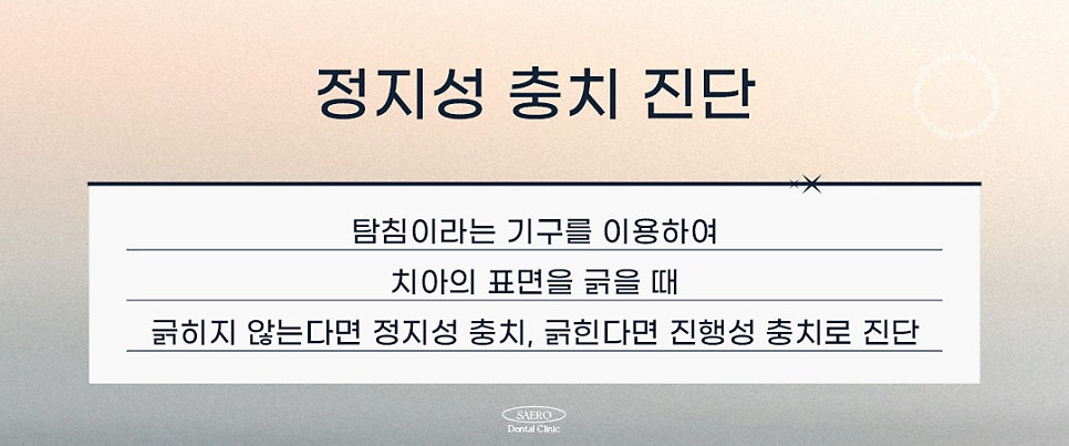 모든 충치가 치료해야 하나요? 그렇지 않은 충치도 있습니다 (정지성충치) 관련 이미지 4