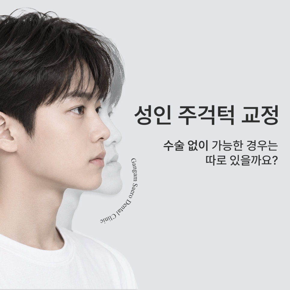 성인 주걱턱, 수술 없이 가능한 경우는 따로 있을까요? 관련 이미지 1