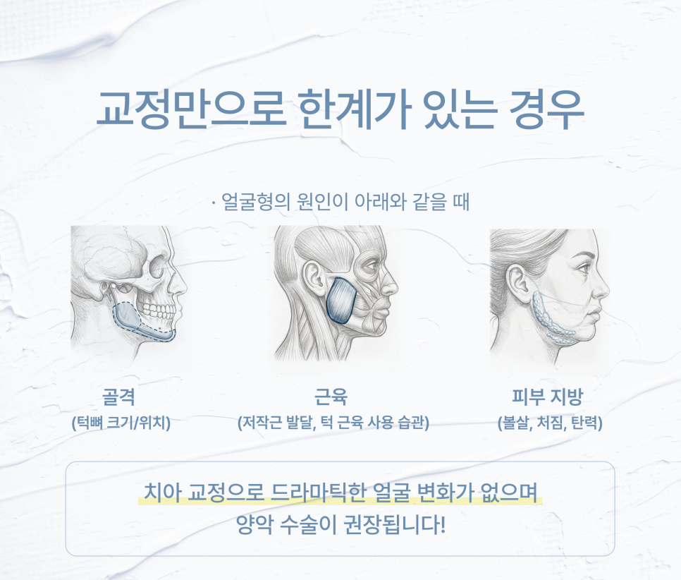 치아 교정 후 얼굴형이 변하는 이유 (교정얼굴형변화) 관련 이미지 3