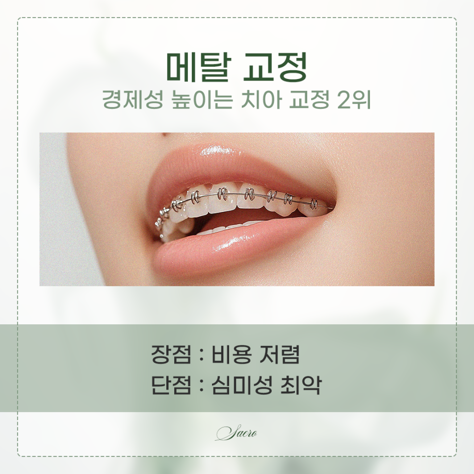 치아교정 가격이 어떻게 되나요? (치아교정비용) 관련 이미지 4