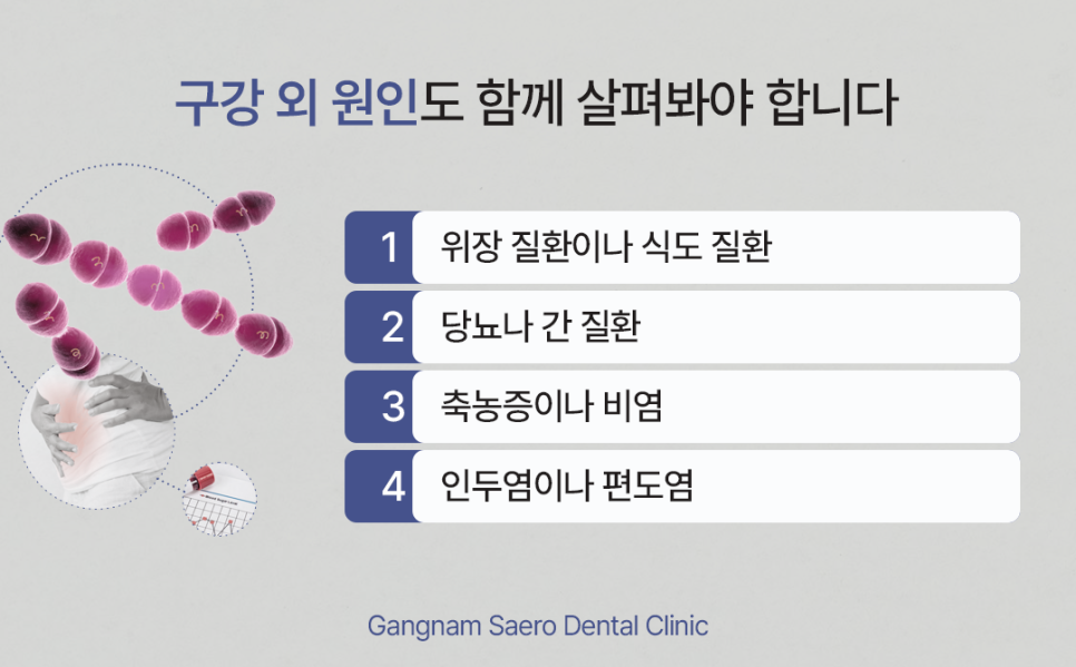 입냄새 치과에서 확인해야 할 몇 가지 (입냄새원인) 관련 이미지 6