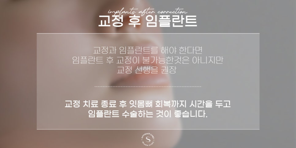 최대 6개월 단축 가능한 2030 임플란트 (원스텝임플란트) 관련 이미지 4
