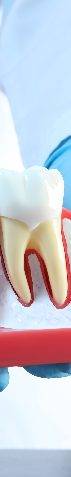 임플란트 치료, 보철물 수명, 교체 시기, 구강을 위해 알아둡시다. 관련 이미지 10