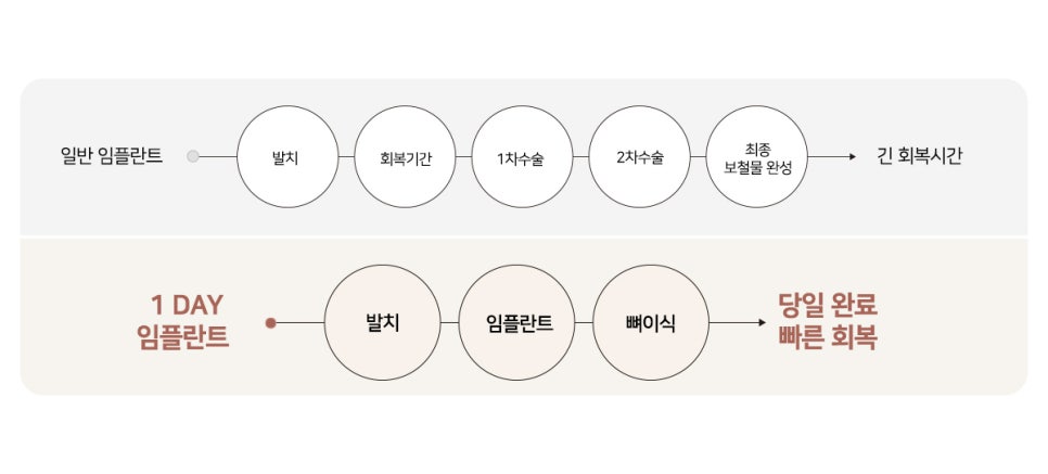 최대 6개월 단축시키는 최단기 임플란트 (당일임플란트) 관련 이미지 3