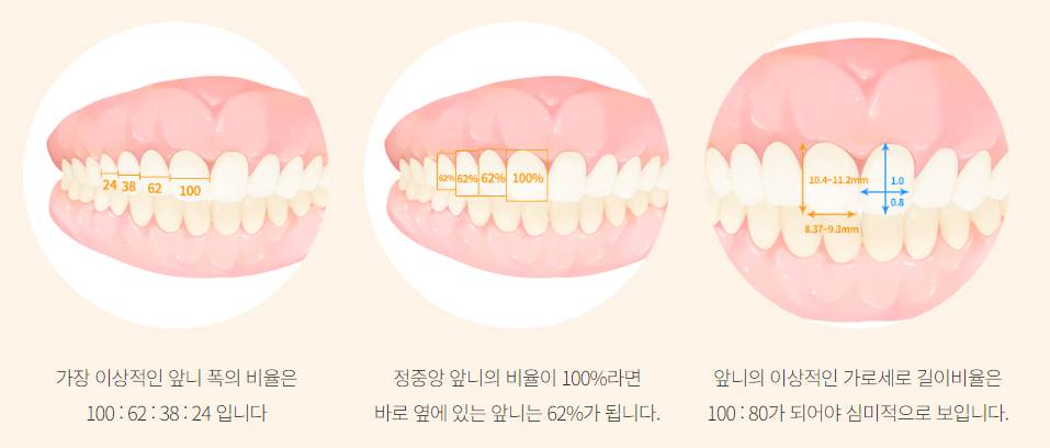 에어네이트의 예술성 (삭제 제로라미네이트) 관련 이미지 5