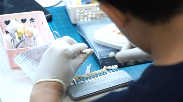 연예인라미네이트, 강남새로치과 에어네이트 관련 이미지 8