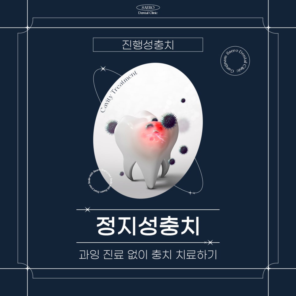 모든 충치가 치료해야 하나요? 그렇지 않은 충치도 있습니다 (정지성충치) 관련 이미지 1