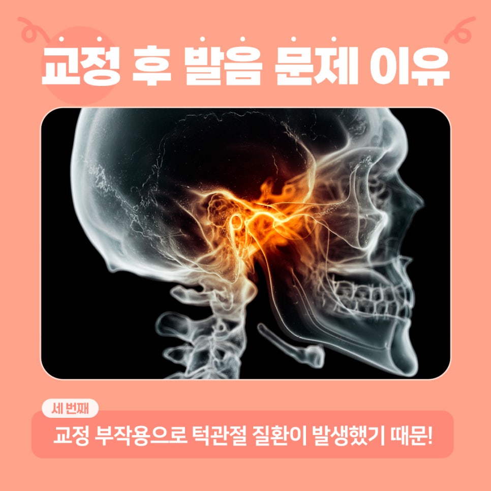 치아교정하면 발음이 안 좋아지나요? (치아교정발음) 관련 이미지 4