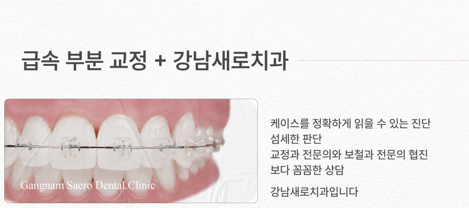 치아 일부만 교정하고 싶다면 비용과 시간을 절약하는 (급속부분교정) 관련 이미지 10
