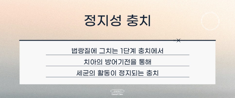 과잉 진료 없이 충치 치료하기 (정지성충치) 관련 이미지 3