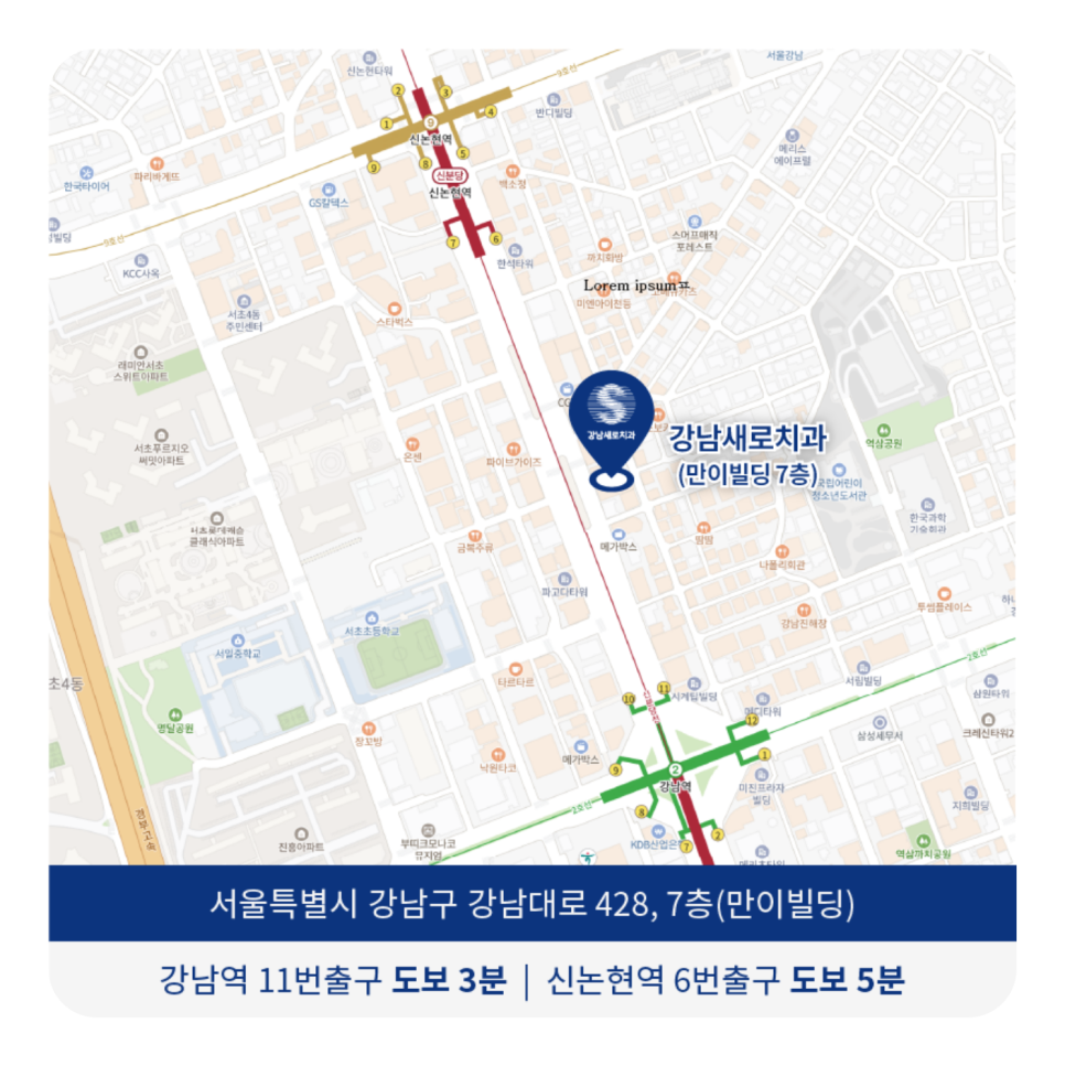 콤플렉스인 뻐드렁니 돌출입 교정으로 개선이 가능할까? 관련 이미지 13