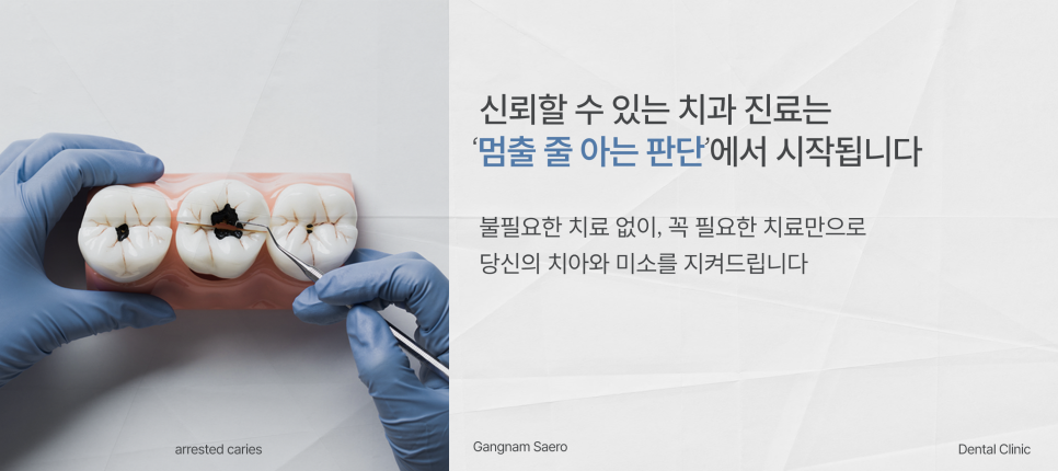 Is There a Cavity That Doesn’t Need Treatment? (Arrested Caries) image 7