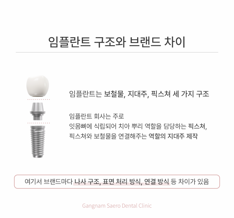 임플란트회사, 임플란트종류 선택 가이드 관련 이미지 4