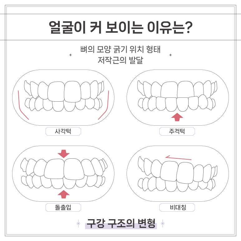 연예인 교정 얼굴 작아지는 법 (교정을 하면 얼굴형이 달라지나요?) [ 강남새로치과 ] 관련 이미지 2