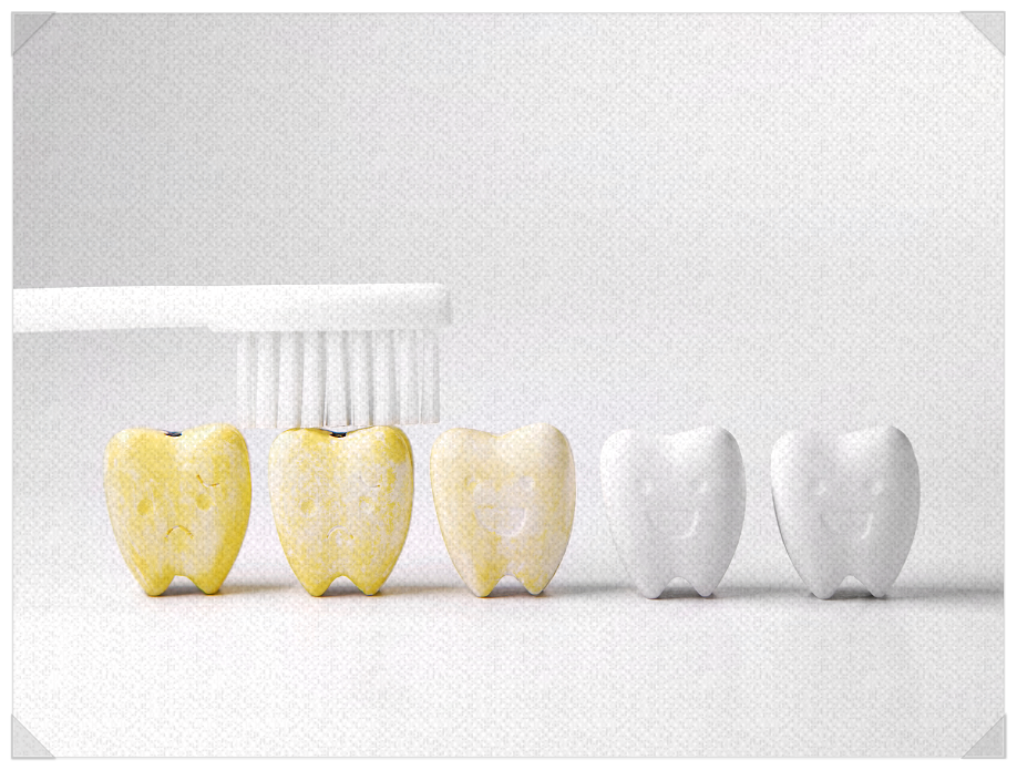 누런 앞니가 고민이라면? 원인과 해결 방법 관련 이미지 3