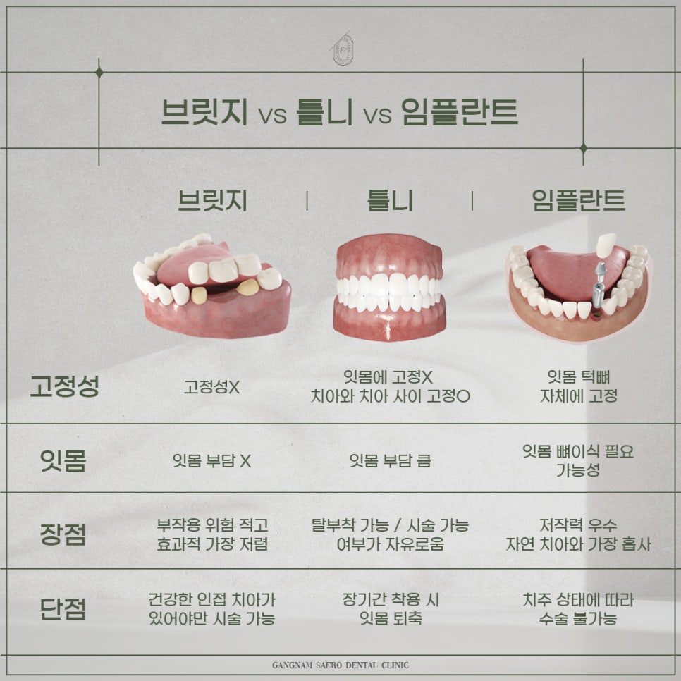 임플란트 말고 대체 치아 치료법 없나요? (브릿지) 관련 이미지 3