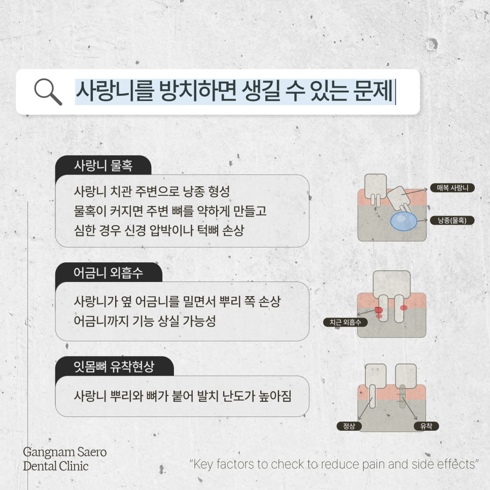 (사랑니발치) 통증과 부작용을 줄이기 위해 확인해야 할 것들 관련 이미지 4