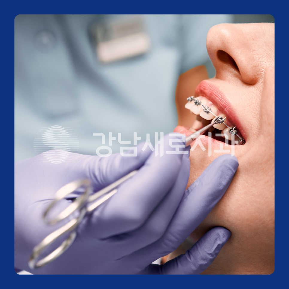 치아 교정 후 부작용이 발생하는 원인? 관련 이미지 2