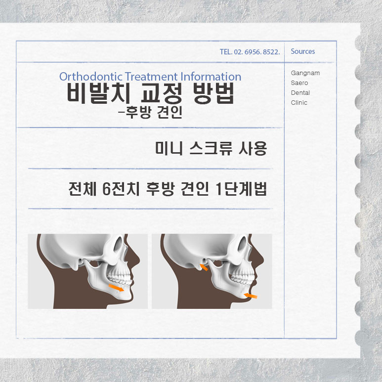 교정 전 발치 필수인가요? (비발치 중심 치아 교정) 관련 이미지 6