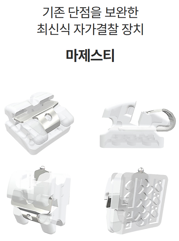 최신식 자가 결찰 교정 장치를 찾는다면? (오스템교정) 관련 이미지 2