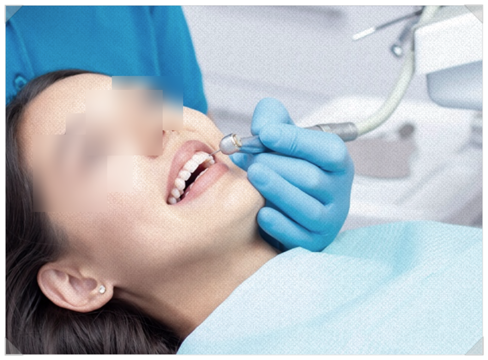 누런 앞니가 고민이라면? 원인과 해결 방법 관련 이미지 4