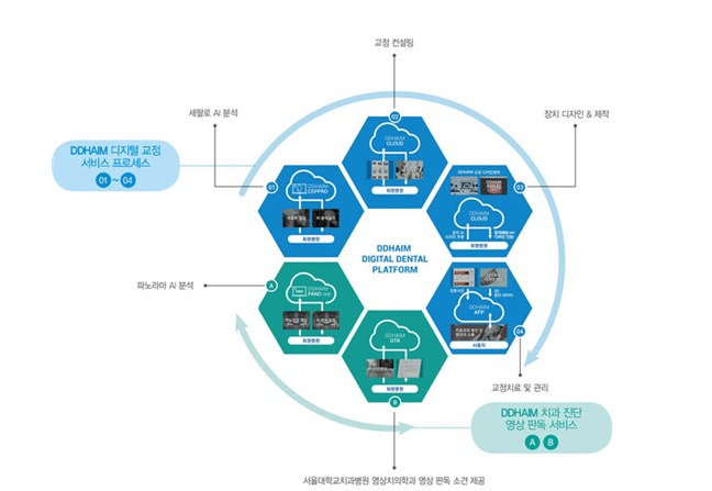 투명교정회사 투명교정종류 투명교정장치 (5) 디디하임 관련 이미지 3