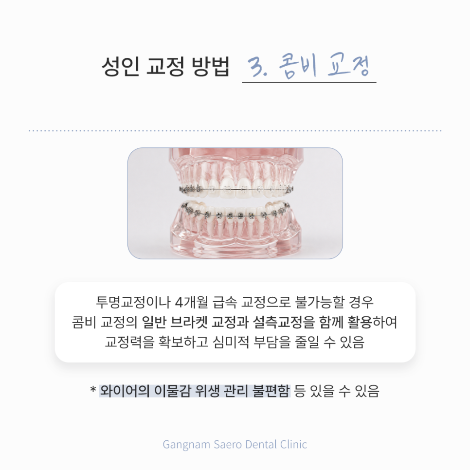 Adult Orthodontics: A Brighter Smile with Orthodontic Treatment in Your 20s and 30s image 5