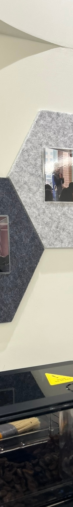 뻐드렁니교정치료, 돌출입을 단기간에 개선하는 방법? 관련 이미지 19