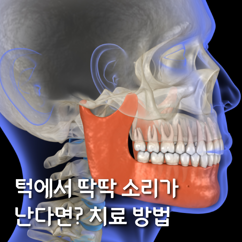 턱에서 딱딱 소리가 난다면? 치료방법 관련 이미지 1
