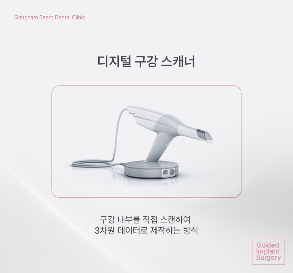 Implants with Less Swelling and Pain Burden (Navigation-Guided Implants) image 5