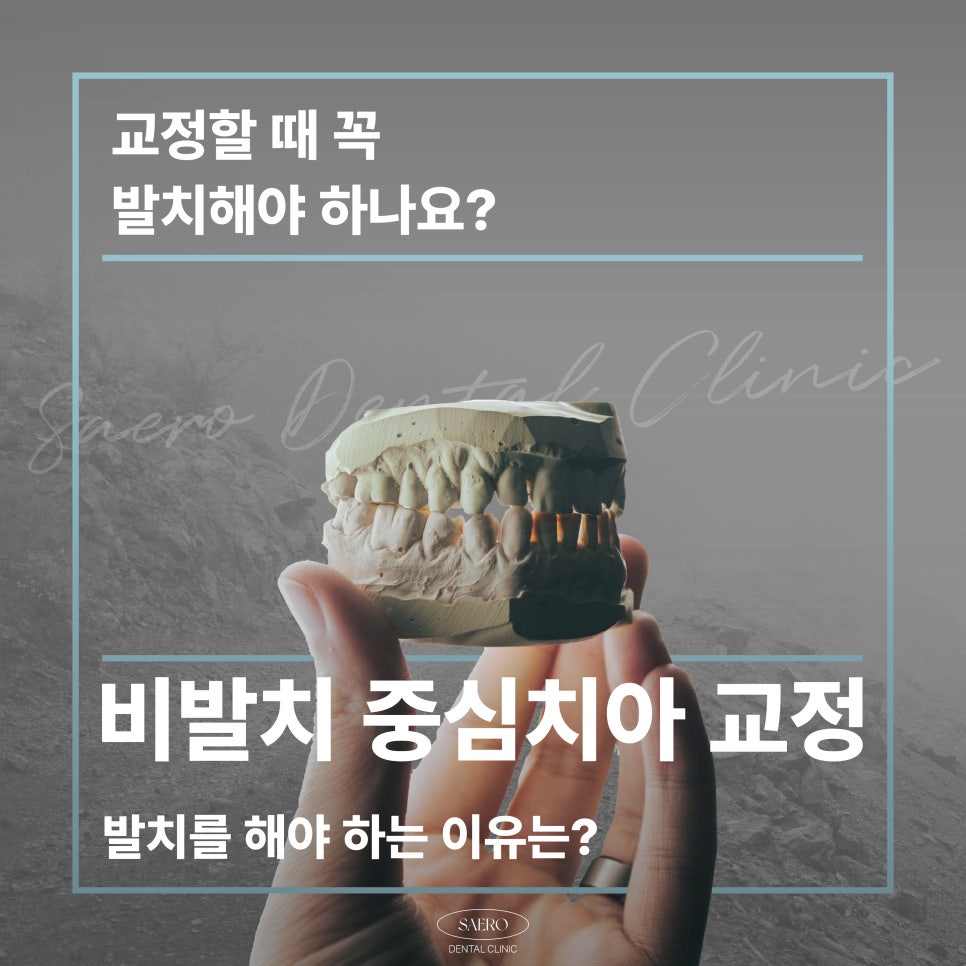 무조건 비발치교정 이 좋은 선택일까요? (발치교정이유 비발치교정이유) 관련 이미지 1