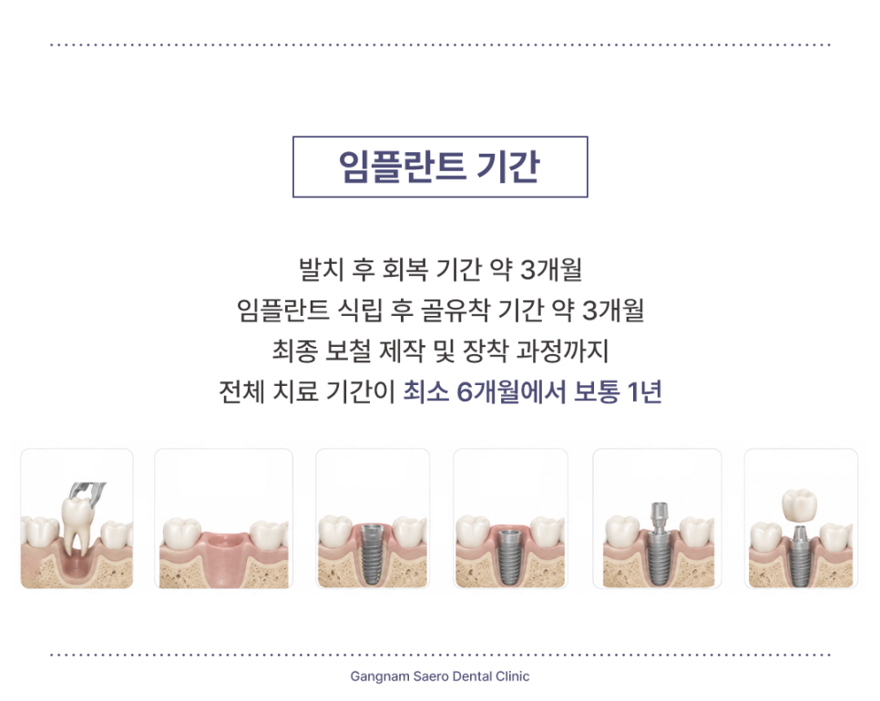 Shortening the Implant Treatment Period: From Tooth Extraction to Implant Placement with a One-Day System image 2