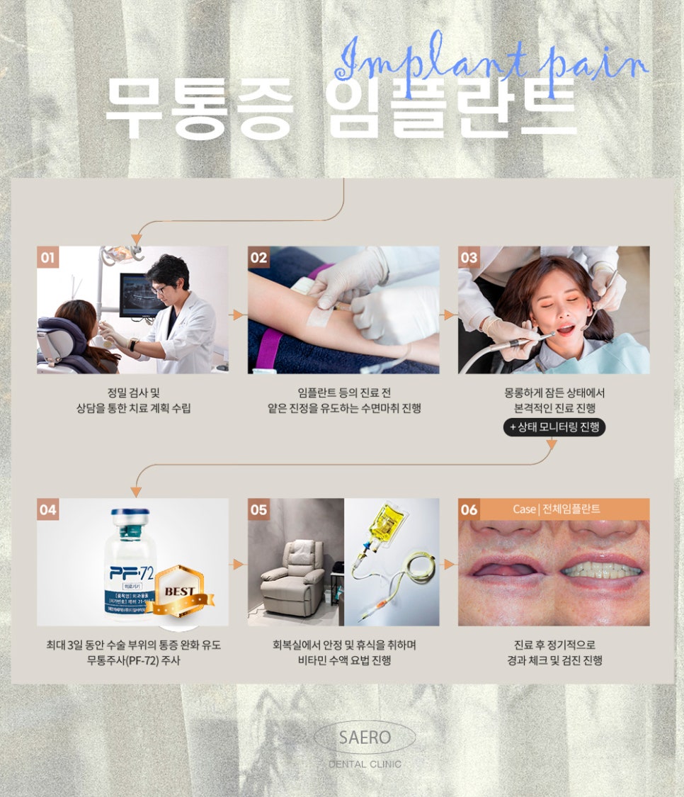 임플란트 많이 아픈가요? 무통증임플란트 (임플란트통증) 관련 이미지 6