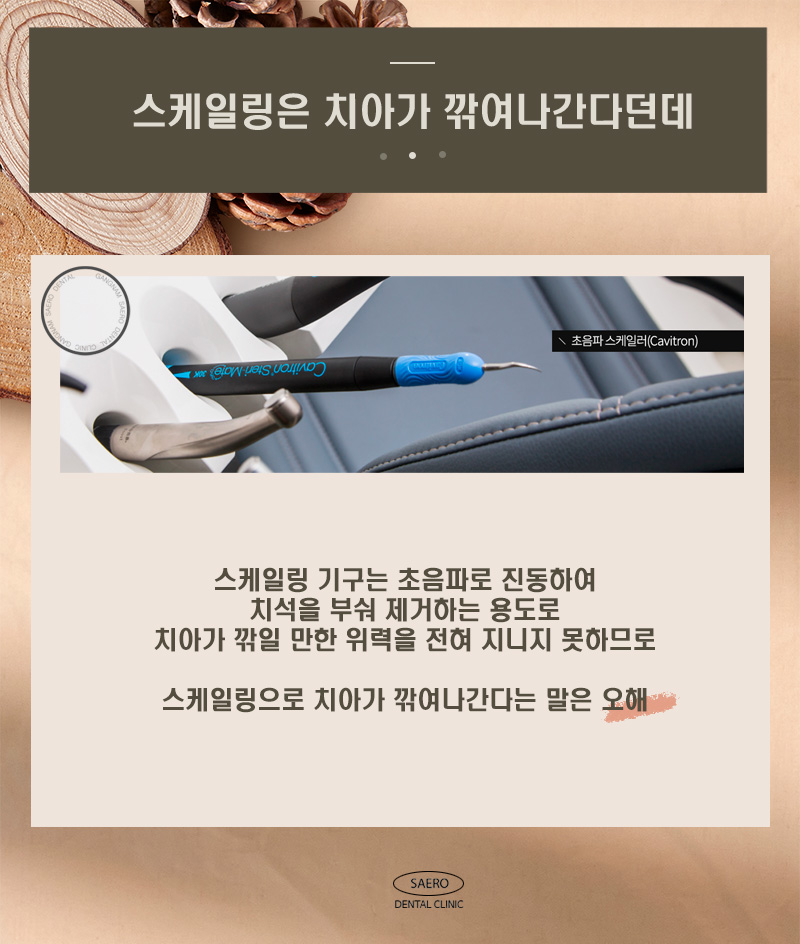 스케일링 오해와 진실 (치아 깎임, 흔들림, 벌어짐, 이시림, 무통스케일링) 관련 이미지 2