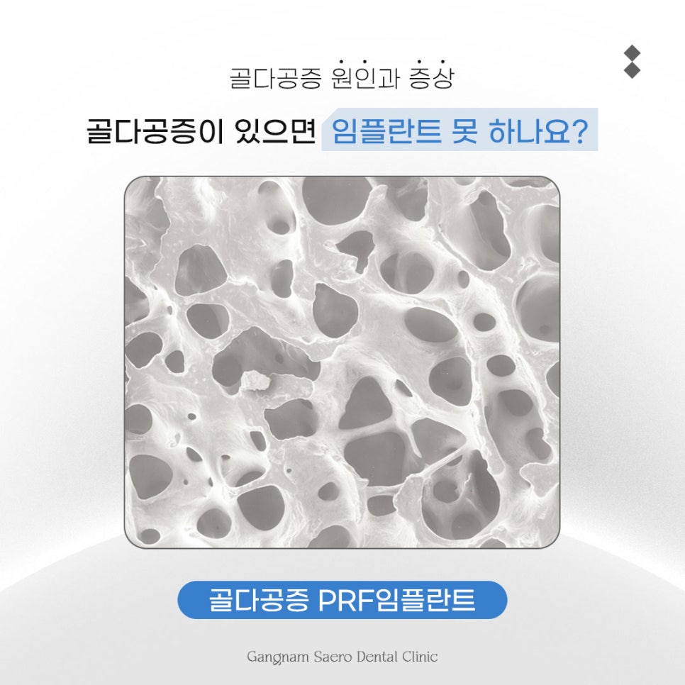 골다공증 있으면 임플란트 못 하나요? 골다공증 원인과 증상 관련 이미지 1
