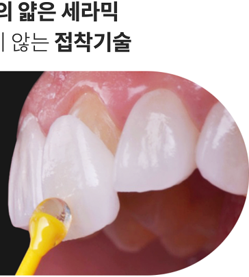 헨리라미네이트, 보다 안전한 진행 과정의 에어네이트로 관련 이미지 13