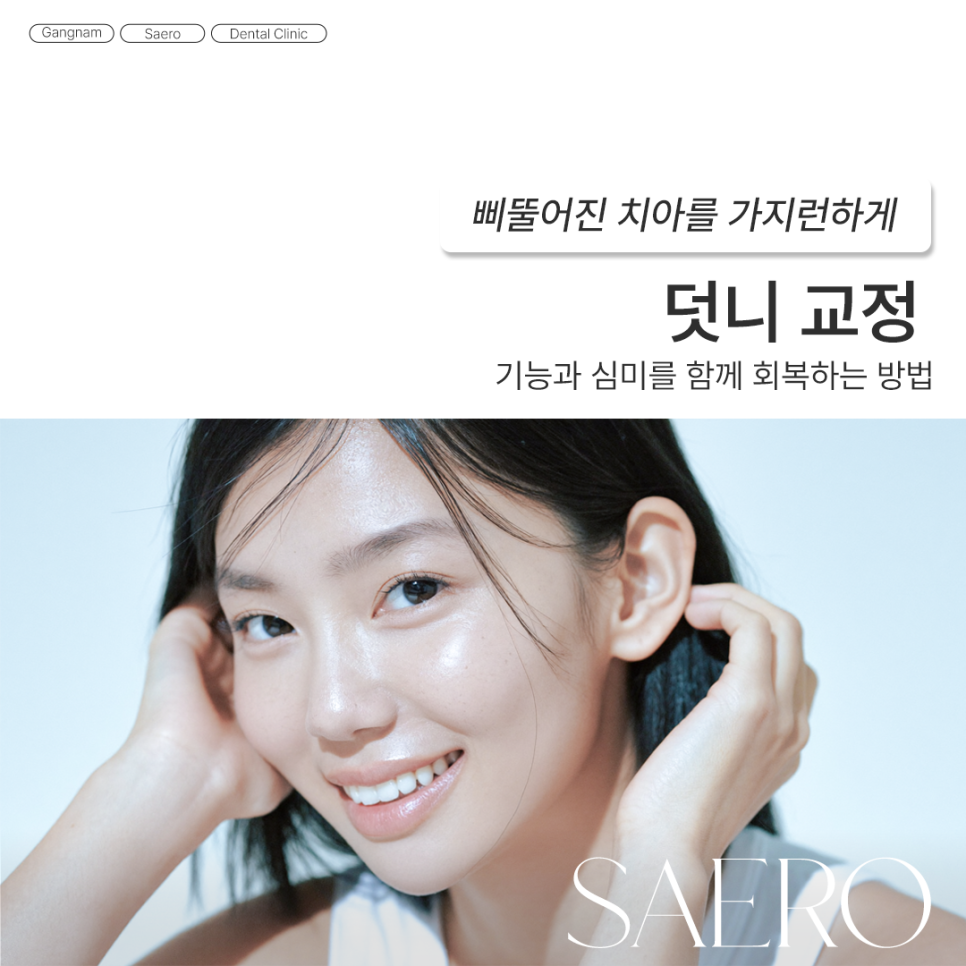 삐뚤어진 치아를 가지런하게 기능과 심미 회복 (덧니교정) 관련 이미지 1