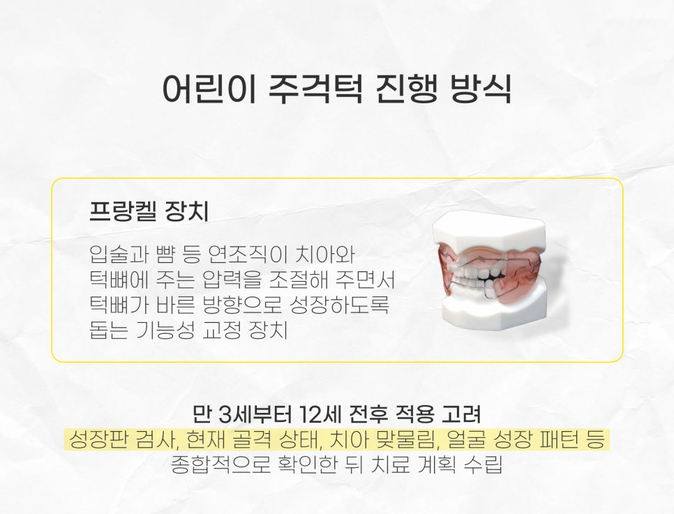 주걱턱 수술 없이 교정하려면 조기 치료가 핵심 (어린이 비수술주걱턱) 관련 이미지 3