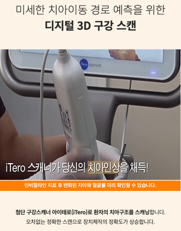 투명치아교정, 발치없이 인비절라인으로 치료 진행 관련 이미지 4